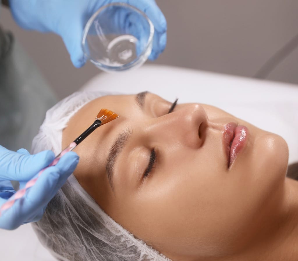 Peeling Wajah untuk Flek, Bekas Jerawat & Kulit Kusam di Boyolali dan Solo
