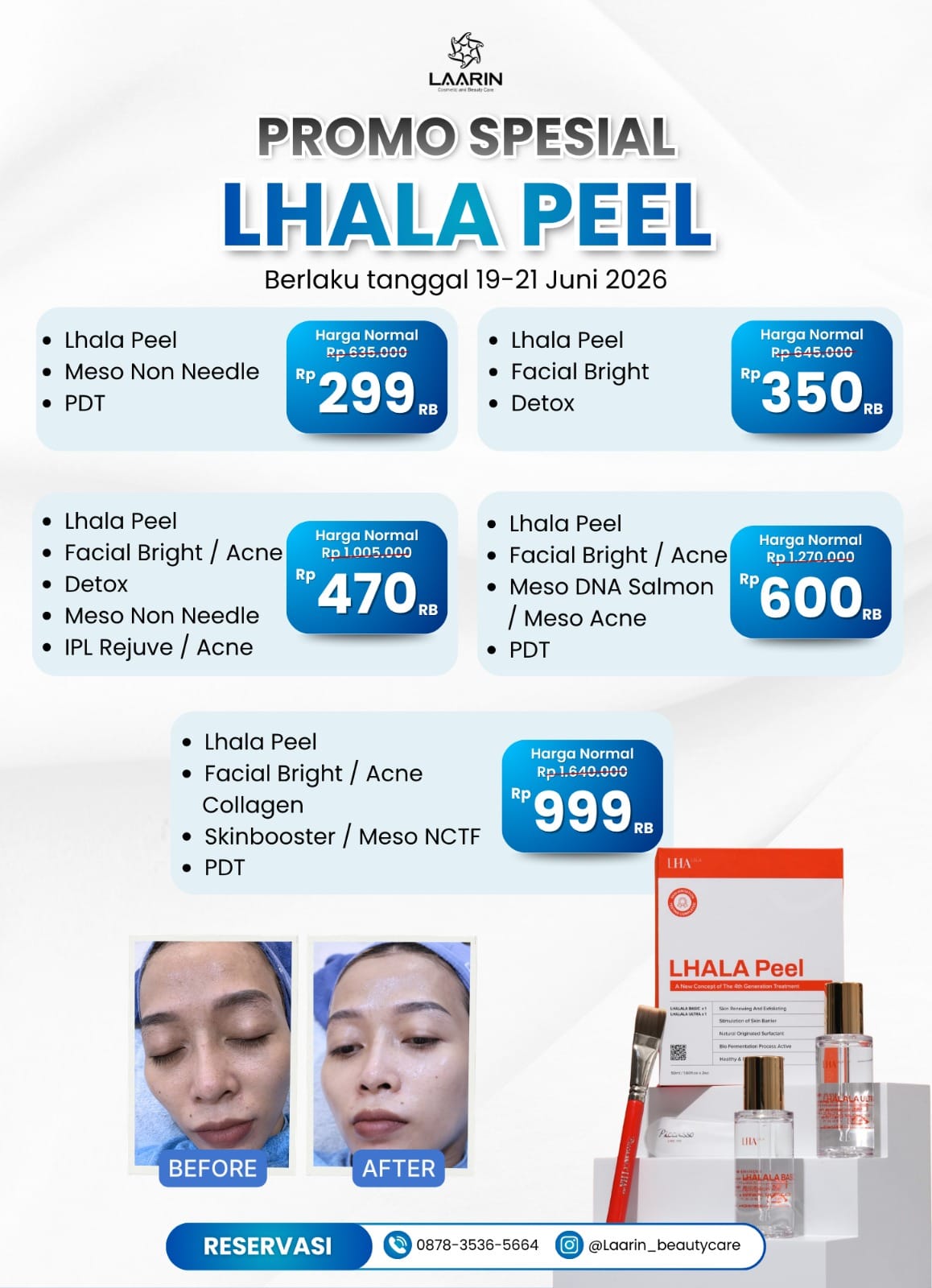 Lhala Peel Boyolali dan Solo: Treatment Korea untuk Kulit Glowing yang Sedang Banyak Dicari, Promo Spesial 19–21 Juni 2026